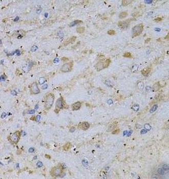 GAD2 Rabbit Polyclonal Antibody