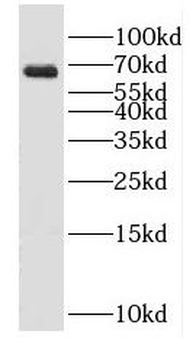 GAD2 Rabbit Polyclonal Antibody
