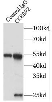 GADD45GIP1 Antibody