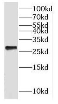 GADD45GIP1 Antibody