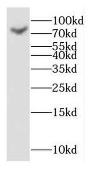 GAGE7 Rabbit Polyclonal Antibody