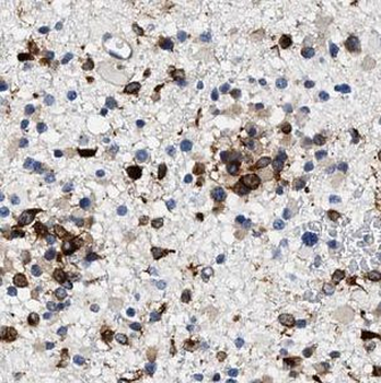 GAGE7 Rabbit Polyclonal Antibody