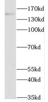 GAK Rabbit Polyclonal Antibody