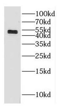 GAL3ST3 Rabbit Polyclonal Antibody