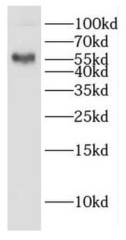 GAL3ST4 Rabbit Polyclonal Antibody