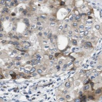 LGALS1 Mouse Monoclonal Antibody