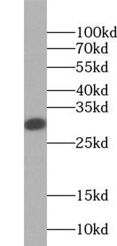 LGALS3 Antibody