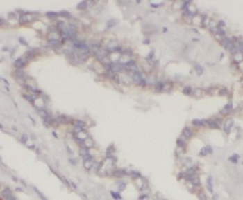 LGALS3 Antibody