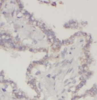 LGALS3 Antibody