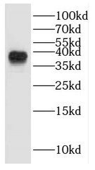 GALM Rabbit Polyclonal Antibody