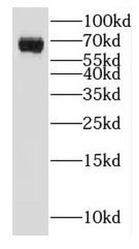 GALNT14 Rabbit Polyclonal Antibody