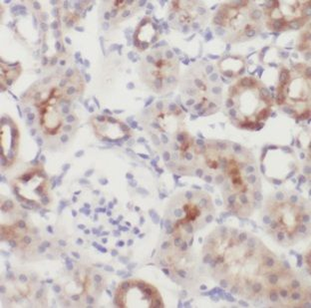 GALNT14 Rabbit Polyclonal Antibody