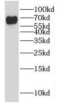 GALNT4 Rabbit Polyclonal Antibody