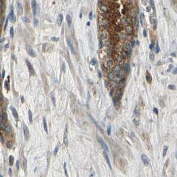 GALNT4 Rabbit Polyclonal Antibody