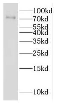 GALNT7 Rabbit Polyclonal Antibody