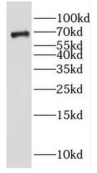 GALNT9 Rabbit Polyclonal Antibody