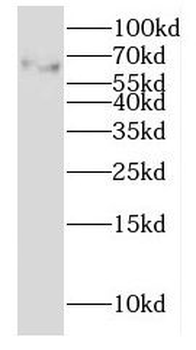GALNT15 Rabbit Polyclonal Antibody