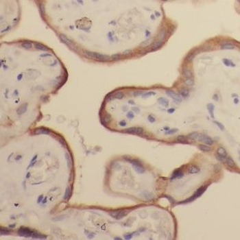 GALNT15 Rabbit Polyclonal Antibody