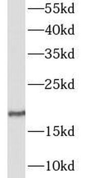 GALP Rabbit Polyclonal Antibody