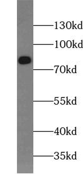 JUP Rabbit Polyclonal Antibody