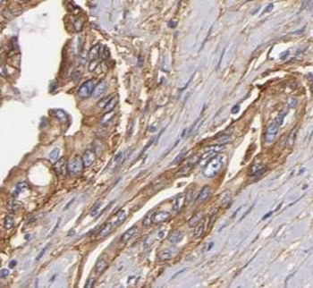 JUP Rabbit Polyclonal Antibody