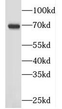 GAN Rabbit Polyclonal Antibody