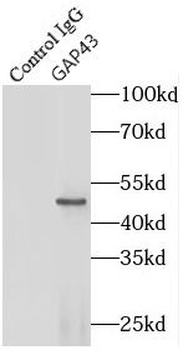 GAP43 Rabbit Polyclonal Antibody