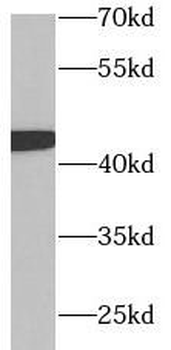 GAP43 Rabbit Polyclonal Antibody