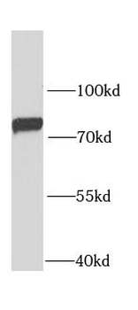 GARS1 Antibody