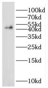 GAS7 Rabbit Polyclonal Antibody