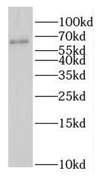 GAS8 Rabbit Polyclonal Antibody