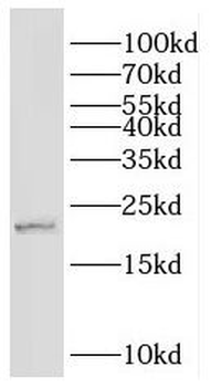 GKN1 Rabbit Polyclonal Antibody