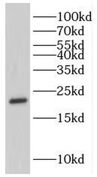 GKN1 Rabbit Polyclonal Antibody