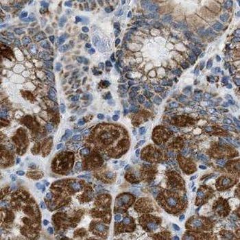 GKN1 Rabbit Polyclonal Antibody