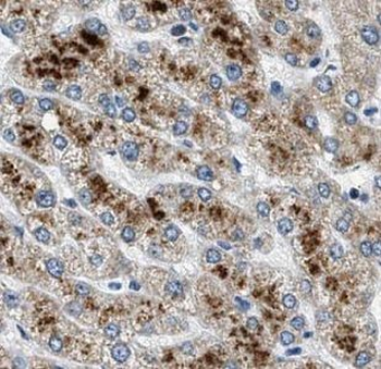 GATC Rabbit Polyclonal Antibody