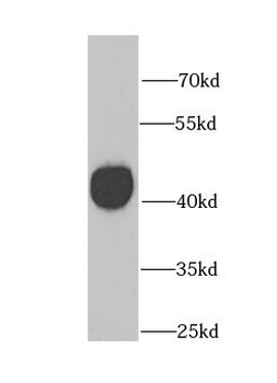 GATM Rabbit Polyclonal Antibody