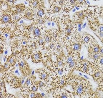 GATM Rabbit Polyclonal Antibody