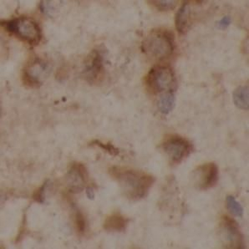 GBA1 Antibody