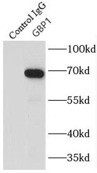 GBP1 Antibody