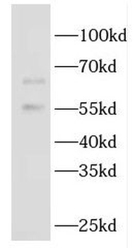 GBP5 Rabbit Polyclonal Antibody