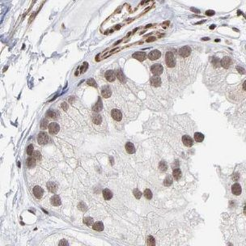 GBP5 Rabbit Polyclonal Antibody