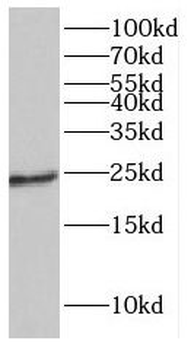 GUCA1A Rabbit Polyclonal Antibody