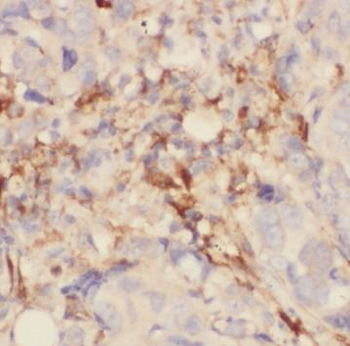 PIP Rabbit Polyclonal Antibody