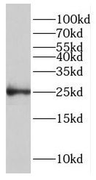 GCSAM Antibody