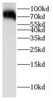 GCLC Rabbit Polyclonal Antibody