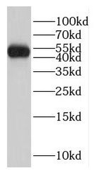 GCM2 Rabbit Polyclonal Antibody