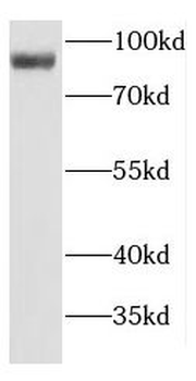 MOGS Rabbit Polyclonal Antibody