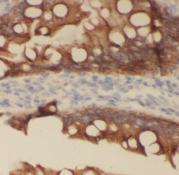 MOGS Rabbit Polyclonal Antibody