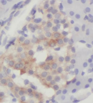 CSF3 Rabbit Polyclonal Antibody