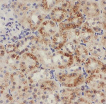 GCSH Rabbit Polyclonal Antibody
